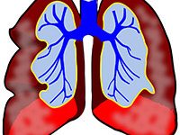 Ilustración de los pulmones. Se ven los dos pulmones sin más información.