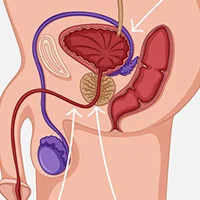 Ilustración de la próstata